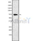 DF9427 at 1/100 staining Mouse kidney tissue by IHC-P. The sample was formaldehyde fixed and a heat mediated antigen retrieval step in citrate buffer was performed. The sample was then blocked and incubated with the antibody for 1.5 hours at 22¡ãC. An HRP conjugated goat anti-rabbit antibody was used as the secondary