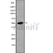 Western blot analysis of CNDP2 using K562 whole cell lysates