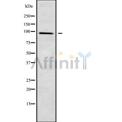 Western blot analysis of extracts from HepG2, using PLA2G4F Antibody. Lane 1 was treated with the blocking peptide.