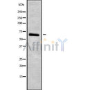 DF9431 at 1/100 staining Human prostate tissue by IHC-P. The sample was formaldehyde fixed and a heat mediated antigen retrieval step in citrate buffer was performed. The sample was then blocked and incubated with the antibody for 1.5 hours at 22¡ãC. An HRP conjugated goat anti-rabbit antibody was used as the secondary
