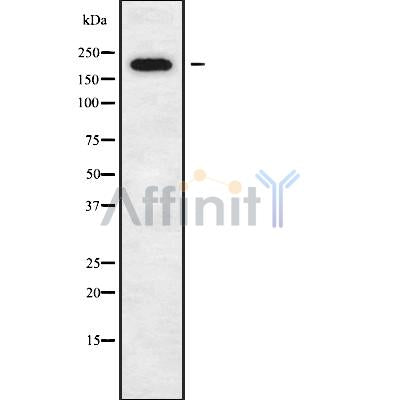Western blot analysis of DOCK11 using K562 whole cell lysates