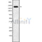 Western blot analysis of DOCK11 using K562 whole cell lysates