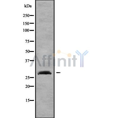 Western blot analysis of DHRS10 using K562 whole cell lysates