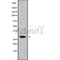 Western blot analysis of DHRS11 using Jurkat whole cell lysates