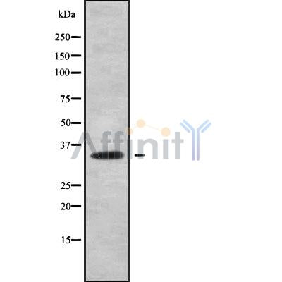 DF9438 at 1/100 staining Mouse colon tissue by IHC-P. The sample was formaldehyde fixed and a heat mediated antigen retrieval step in citrate buffer was performed. The sample was then blocked and incubated with the antibody for 1.5 hours at 22¡ãC. An HRP conjugated goat anti-rabbit antibody was used as the secondary