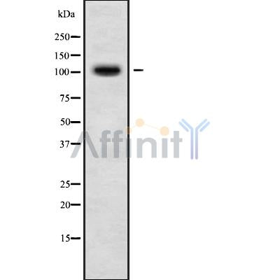 Western blot analysis of DSG3 using LOVO whole cell lysates