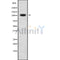 Western blot analysis of DSG3 using LOVO whole cell lysates