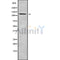 Western blot analysis of DSG4 using HeLa whole cell lysates