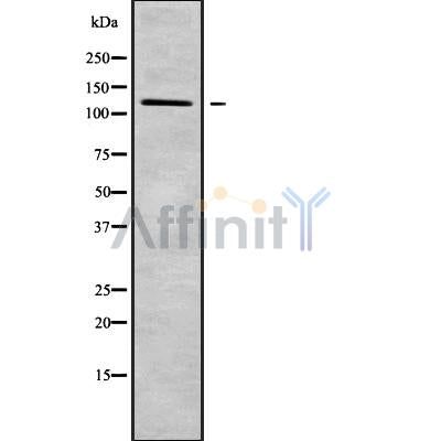 Western blot analysis of DSG4 using HeLa whole cell lysates