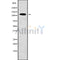 Western blot analysis of ASAP2 using LOVO whole cell lysates