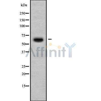 Western blot analysis of DCLRE1B using COLO205 whole cell lysates