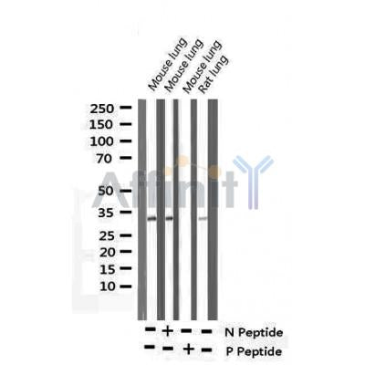 AF3108 staining HepG2 by IF/ICC. The sample were fixed with PFA and permeabilized in 0.1% Triton X-100,then blocked in 10% serum for 45 minutes at 25¡ãC. The primary antibody was diluted at 1/200 and incubated with the sample for 1 hour at 37¡ãC. An  Alexa Fluor 594 conjugated goat anti-rabbit IgG (H+L) Ab, diluted at 1/600, was used as the secondary antibod