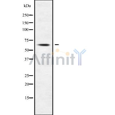 DF9447 at 1/100 staining Human lung tissue by IHC-P. The sample was formaldehyde fixed and a heat mediated antigen retrieval step in citrate buffer was performed. The sample was then blocked and incubated with the antibody for 1.5 hours at 22¡ãC. An HRP conjugated goat anti-rabbit antibody was used as the secondary