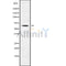 DF9447 at 1/100 staining Human lung tissue by IHC-P. The sample was formaldehyde fixed and a heat mediated antigen retrieval step in citrate buffer was performed. The sample was then blocked and incubated with the antibody for 1.5 hours at 22¡ãC. An HRP conjugated goat anti-rabbit antibody was used as the secondary