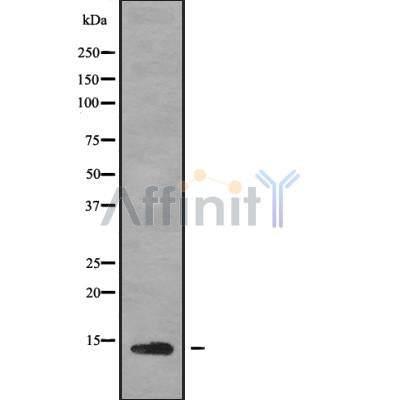 DF9448 at 1/100 staining Human kidney tissue by IHC-P. The sample was formaldehyde fixed and a heat mediated antigen retrieval step in citrate buffer was performed. The sample was then blocked and incubated with the antibody for 1.5 hours at 22¡ãC. An HRP conjugated goat anti-rabbit antibody was used as the secondary