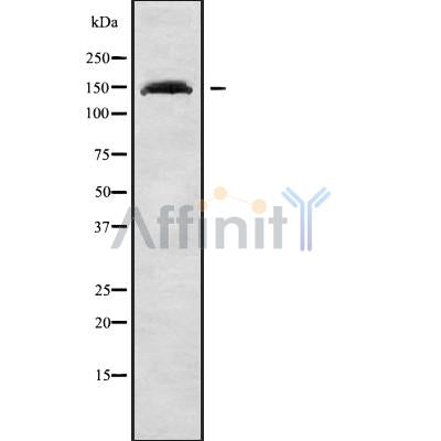 Western blot analysis of extracts from HepG2, using POLG1 Antibody. The lane on the left was treated with blocking peptide.