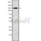Western blot analysis of extracts from HepG2, using POLG1 Antibody. The lane on the left was treated with blocking peptide.