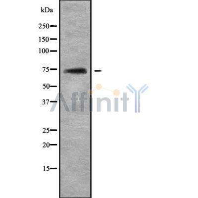 Western blot analysis of TOP1MT using COLO205 whole cell lysates