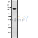 Western blot analysis of DNA2L using COLO205 whole cell lysates