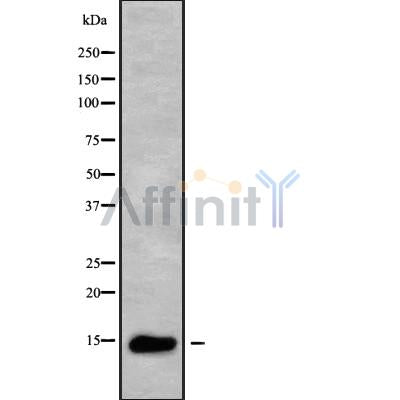 DF9455 at 1/100 staining Human brain tissue by IHC-P. The sample was formaldehyde fixed and a heat mediated antigen retrieval step in citrate buffer was performed. The sample was then blocked and incubated with the antibody for 1.5 hours at 22¡ãC. An HRP conjugated goat anti-rabbit antibody was used as the secondary