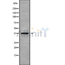 Western blot analysis of TWISTNB using MCF7 whole cell lysates