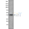 Western blot analysis of TWISTNB using MCF7 whole cell lysates
