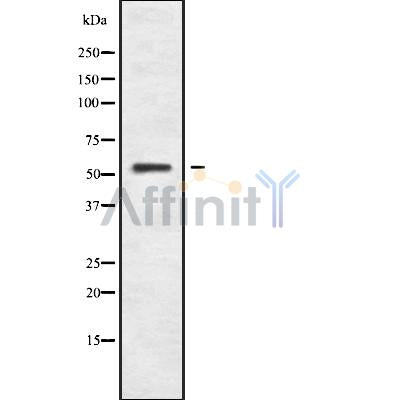DF9457 staining Hela by IF/ICC. The sample were fixed with PFA and permeabilized in 0.1% Triton X-100,then blocked in 10% serum for 45 minutes at 25¡ãC. The primary antibody was diluted at 1/200 and incubated with the sample for 1 hour at 37¡ãC. An  Alexa Fluor 594 conjugated goat anti-rabbit IgG (H+L) Ab, diluted at 1/600, was used as the secondary antibod
