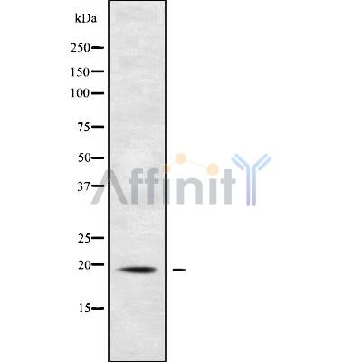 Western blot analysis of extracts from various samples, using RPB7 Antibody.
 Lane 1: Hela treated with blocking peptide.
 Lane 2: Hela;
 Lane 3: HepG2;
 