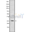 Western blot analysis of RPC7 using HuvEc whole cell lysates