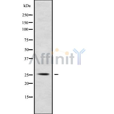 Western blot analysis of RPC7 using HuvEc whole cell lysates