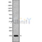 Western blot analysis of POLR1D using COLO205 whole cell lysates