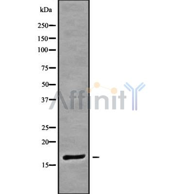 DF9466 at 1/100 staining Rat liver tissue by IHC-P. The sample was formaldehyde fixed and a heat mediated antigen retrieval step in citrate buffer was performed. The sample was then blocked and incubated with the antibody for 1.5 hours at 22¡ãC. An HRP conjugated goat anti-rabbit antibody was used as the secondary