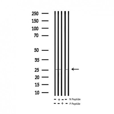 AF3110 staining NIH-3T3 by IF/ICC. The sample were fixed with PFA and permeabilized in 0.1% Triton X-100,then blocked in 10% serum for 45 minutes at 25¡ãC. The primary antibody was diluted at 1/200 and incubated with the sample for 1 hour at 37¡ãC. An  Alexa Fluor 594 conjugated goat anti-rabbit IgG (H+L) Ab, diluted at 1/600, was used as the secondary antibod