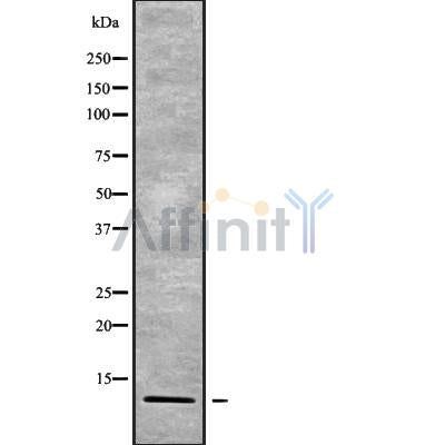 Western blot analysis of RPAB4 using Jurkat whole cell lysates