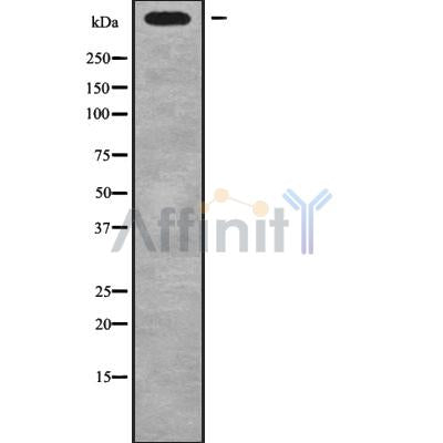DF9469 at 1/100 staining Mouse kidney tissue by IHC-P. The sample was formaldehyde fixed and a heat mediated antigen retrieval step in citrate buffer was performed. The sample was then blocked and incubated with the antibody for 1.5 hours at 22¡ãC. An HRP conjugated goat anti-rabbit antibody was used as the secondary