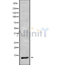 Western blot analysis of extracts from Mouse Myeloma cell, using DYNLRB1 Antibody. Lane 1 was treated with the blocking peptide.