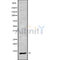 Western blot analysis of extracts from Mouse Myeloma cell, using DYNLRB1 Antibody. Lane 1 was treated with the blocking peptide.