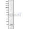Western blot analysis of DYNLT3 using HeLa whole cell lysates