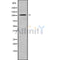 DF9477 at 1/100 staining Human brain cancer tissue by IHC-P. The sample was formaldehyde fixed and a heat mediated antigen retrieval step in citrate buffer was performed. The sample was then blocked and incubated with the antibody for 1.5 hours at 22¡ãC. An HRP conjugated goat anti-rabbit antibody was used as the secondary