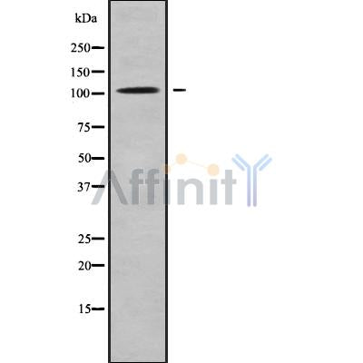 DF9477 at 1/100 staining Human brain cancer tissue by IHC-P. The sample was formaldehyde fixed and a heat mediated antigen retrieval step in citrate buffer was performed. The sample was then blocked and incubated with the antibody for 1.5 hours at 22¡ãC. An HRP conjugated goat anti-rabbit antibody was used as the secondary