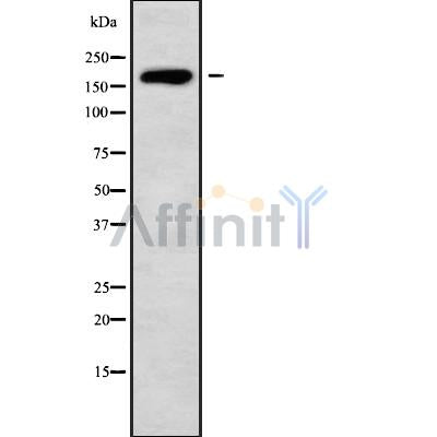 Western blot analysis of HECW1 using K562 whole cell lysates
