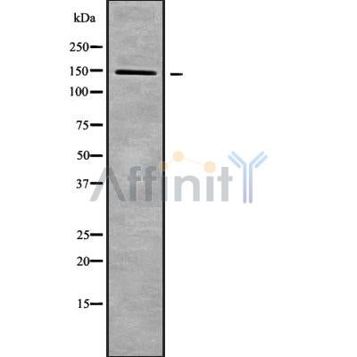 DF9488 at 1/100 staining Human gastric tissue by IHC-P. The sample was formaldehyde fixed and a heat mediated antigen retrieval step in citrate buffer was performed. The sample was then blocked and incubated with the antibody for 1.5 hours at 22¡ãC. An HRP conjugated goat anti-rabbit antibody was used as the secondary