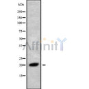 Western blot analysis of RNF5 using Jurkat whole cell lysates