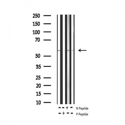 AF3113 staining 293 by IF/ICC. The sample were fixed with PFA and permeabilized in 0.1% Triton X-100,then blocked in 10% serum for 45 minutes at 25¡ãC. The primary antibody was diluted at 1/200 and incubated with the sample for 1 hour at 37¡ãC. An  Alexa Fluor 594 conjugated goat anti-rabbit IgG (H+L) Ab, diluted at 1/600, was used as the secondary antibod
