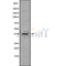 DF9499 at 1/100 staining Mouse pancreas tissue by IHC-P. The sample was formaldehyde fixed and a heat mediated antigen retrieval step in citrate buffer was performed. The sample was then blocked and incubated with the antibody for 1.5 hours at 22¡ãC. An HRP conjugated goat anti-rabbit antibody was used as the secondary