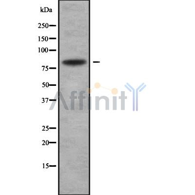 Western blot analysis of CD248 using COLO205 whole cell lysates