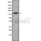 Western blot analysis of CD248 using COLO205 whole cell lysates