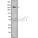 Western blot analysis of EDC4 using Jurkat whole cell lysates