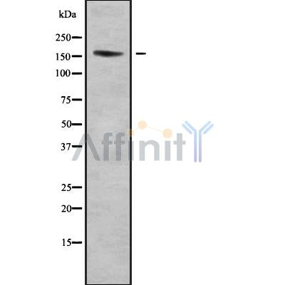 Western blot analysis of EDC4 using Jurkat whole cell lysates