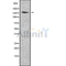 Western blot analysis of EDC4 using Jurkat whole cell lysates
